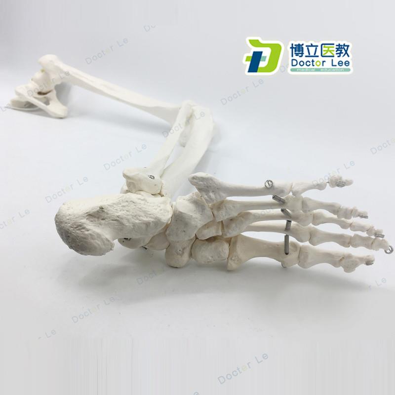 正骨骨科艺用医用下肢大腿骨脚掌模型脚骨M脚模型带胫腓骨和股骨