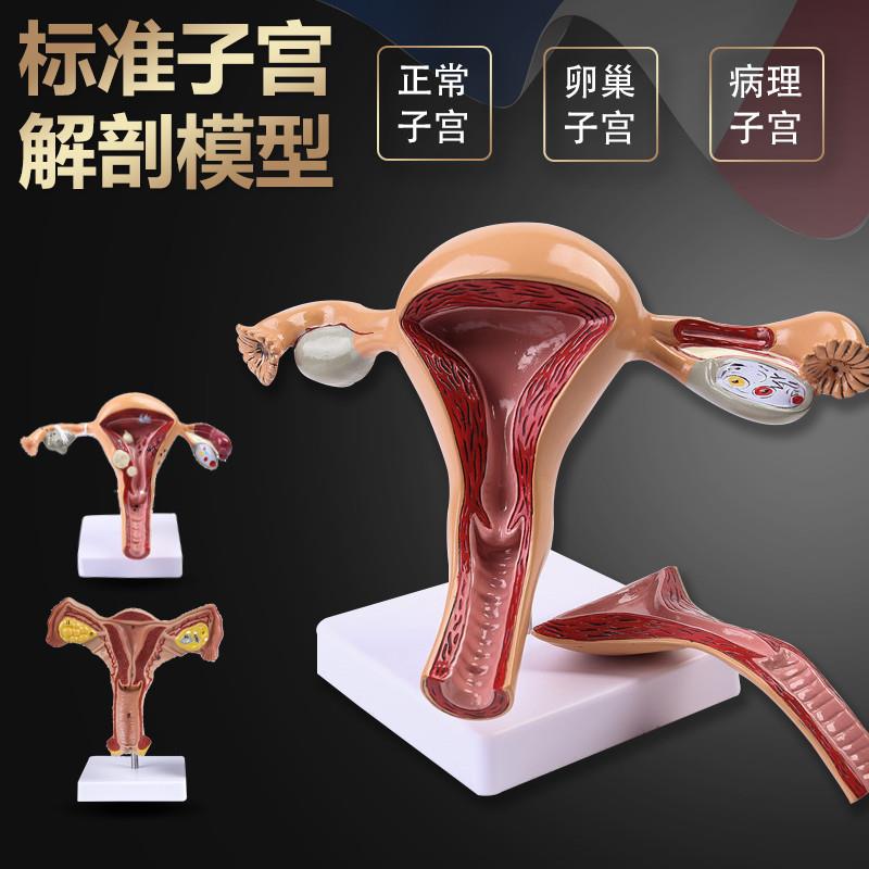 人体模型女性生殖子宫模型医院用病变子宫模型R教具妇科解剖卵巢
