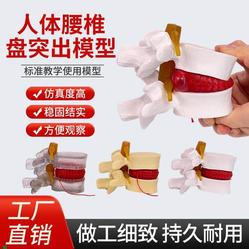 仿真腰椎模型椎间盘1:1人体z骨骼脊柱脊椎解剖医用教学骨架标本