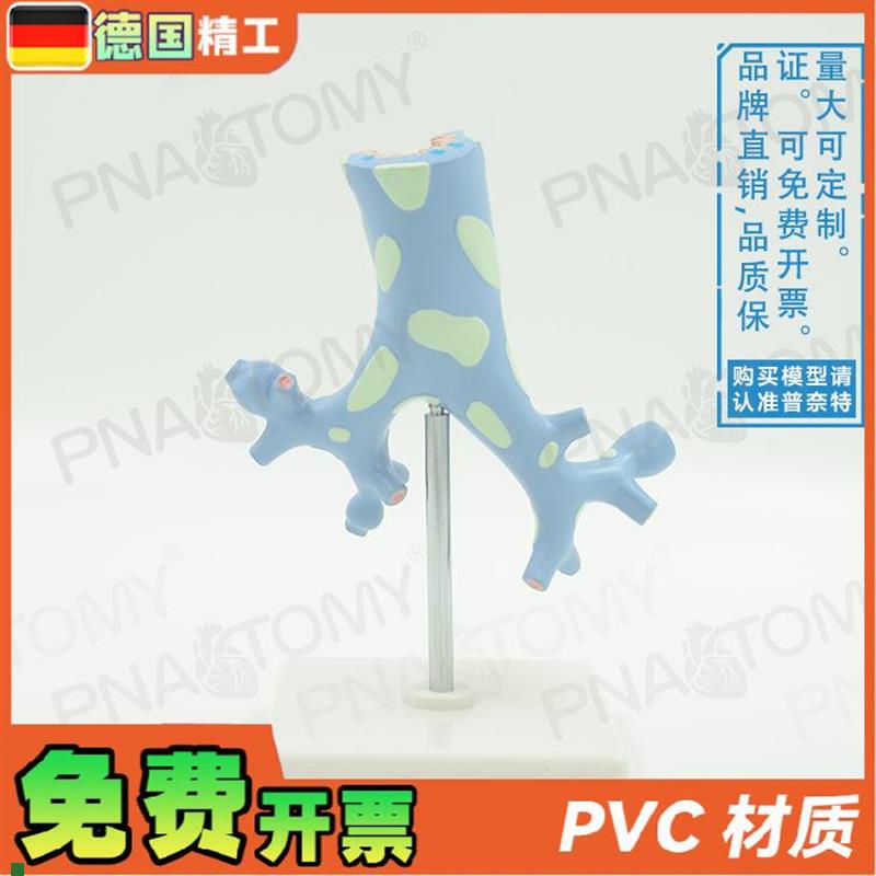 适配德国】新品人体呼吸系统病理肺部支气管树解剖模型教学呼吸科