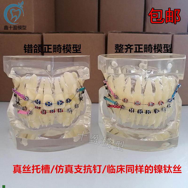 错颌矫正展示扎丝k托槽正畸牙齿模型牙模牙科模型牙齿模型口腔模