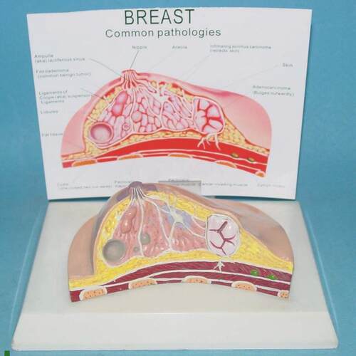 女性乳房病理模型乳房解剖结O构模型医用教学