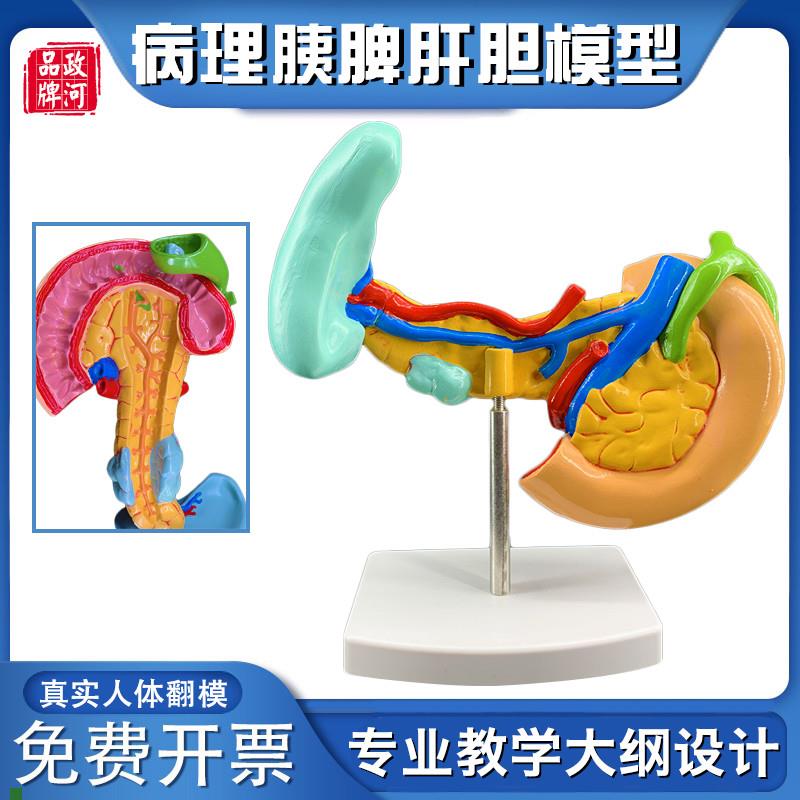 政河病理胰脾肝胆人体器官结构解剖模型医院展示摆件学Z校教学演