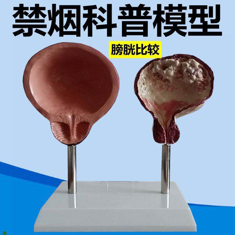 吸烟危害人体健康模型禁烟警示教育多V脏器受损膀胱泌尿生殖心脏