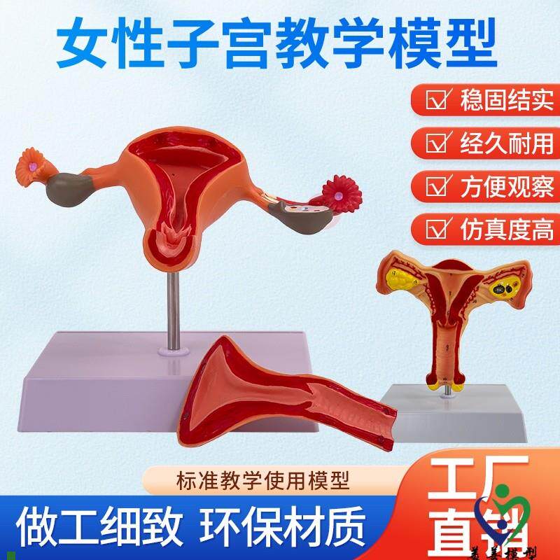 子宫模型生殖器解剖模型计划生育示教模型妇科解剖X教学医学模型