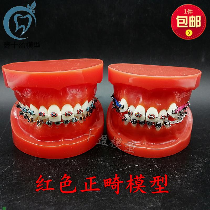 口腔牙列整齐正畸模型红牙列不齐错颌缺失牙齿仿真V牵引皮链支抗
