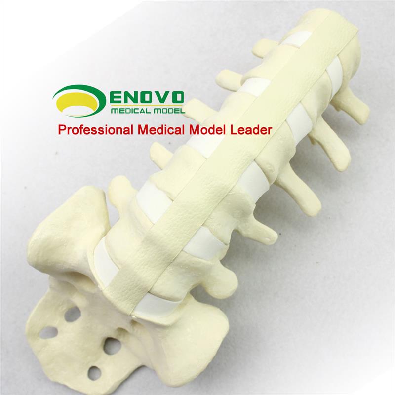 ENOVO颐诺人体仿真腰椎尾骨模型骨科手术前SawboTne人体腰椎钉棒