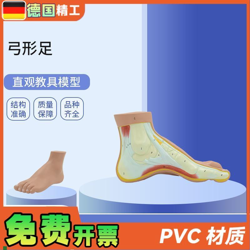 德国】PNT-0727弓形足模型足E部病理模型人体足部解剖模型脚关
