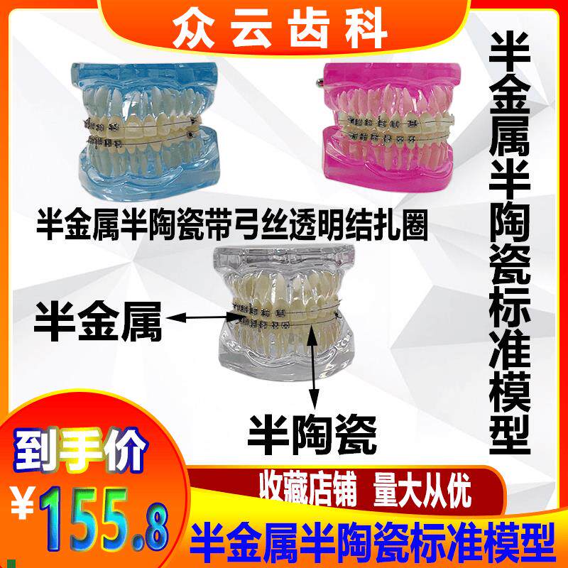 牙科正畸口腔教学演示沟通模型C半金属半陶瓷托槽对比示范模型
