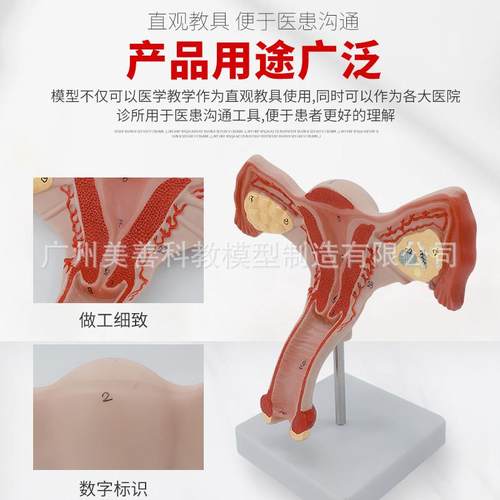 双侧卵巢子宫模型k人体女性生殖子宫解剖阴道卵巢教学妇科生殖科