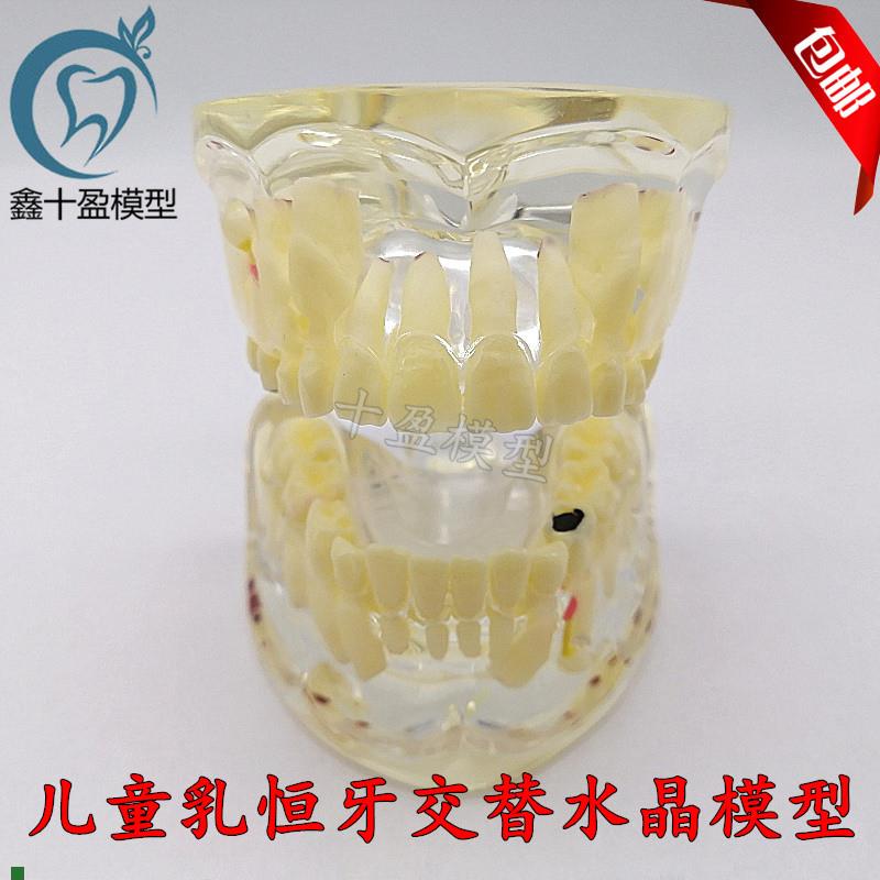 牙科口腔教学模型儿童病q理模型乳牙恒牙交替透明水晶模型M4002