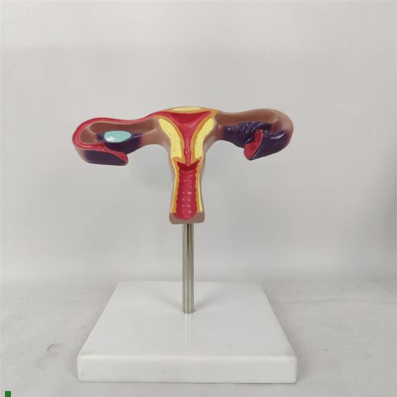 人体子宫解剖模型子宫结构解剖展示女性生殖O系统阴道双侧卵巢子