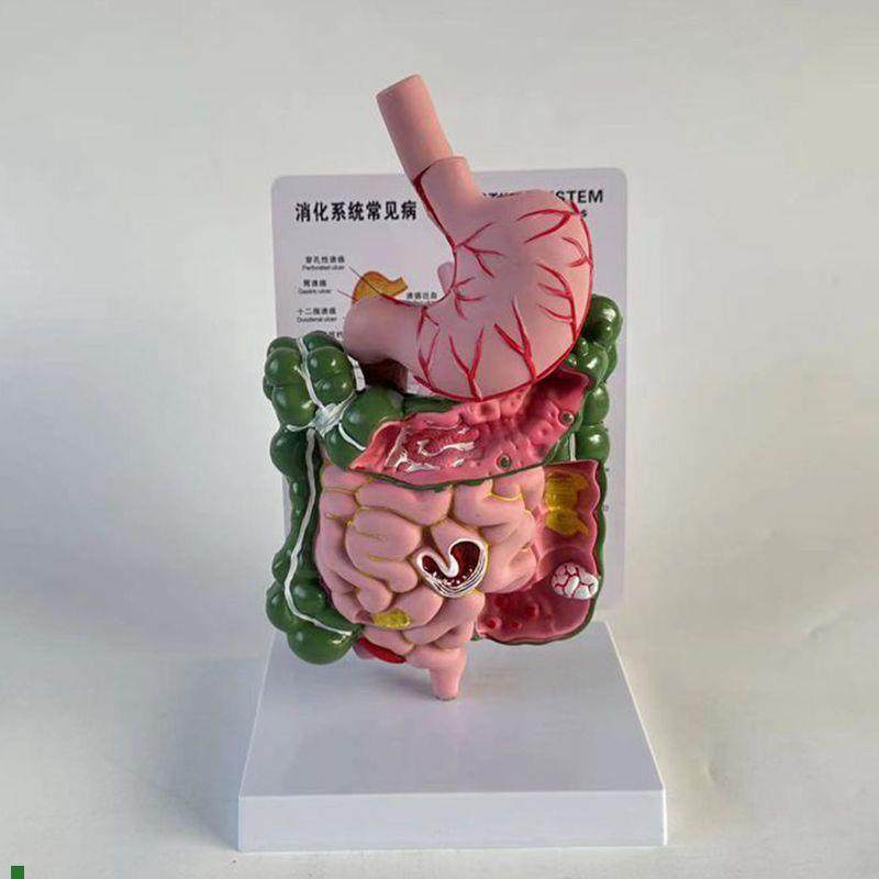 康泰医用模型食管胃肠道病变x桌上型医患示教消化道医药促销直播
