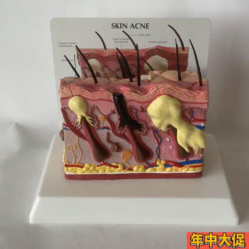人体皮肤放大皮肤痤疮毛发生长头发健康J皮肤脱发毛囊毛细血管黑