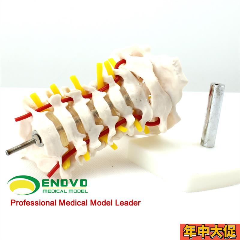 ENOVO颐诺人体颈椎颈动脉模型颈F椎模型寰枢关节人体骨骼标本模