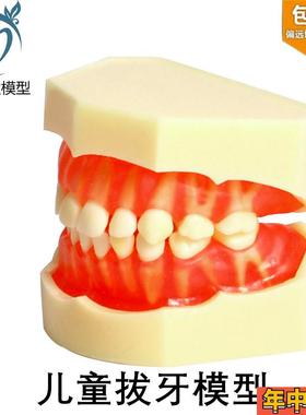 牙科儿童乳牙拔牙模型牙龈牙v齿可拆卸乳牙恒牙乳牙模型M7009包邮