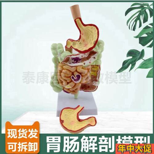 胃肠道模型食管消化道病理盲肠阑尾解剖大小肠P痔疮肛周直肠肉突