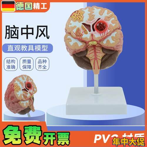 德国】人体脑解剖模型脑出血动脉大脑动J静脉畸形脑病理大脑教具