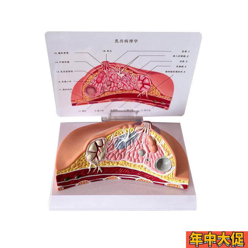 乳房模型b乳腺增生家政培训妇产乳腺演示哺乳期乳房构造催乳师教