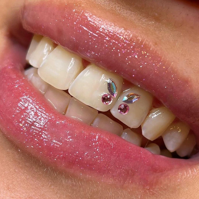 牙钻自己粘diy材料包马眼蝴蝶镶钻爆闪口腔牙齿饰品美白贴面工具