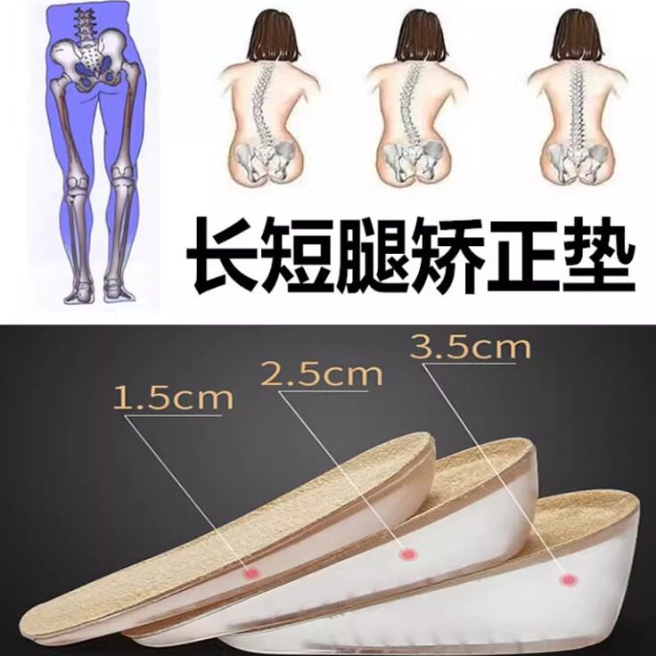 长短腿矫正鞋垫舒适儿童高低脚定制防盆骨倾斜脊柱侧弯下肢不等长