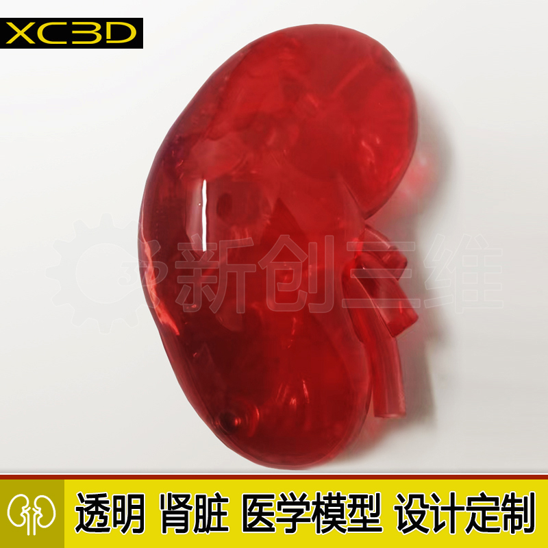 3D打印医疗医学透明肾脏模型订制