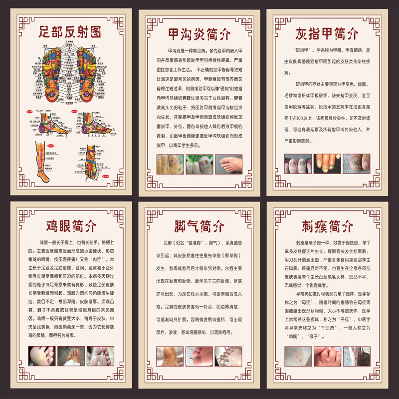 足疗洗脚泡脚足浴店保健按摩灰指甲养生馆广告海报宣传画墙贴纸