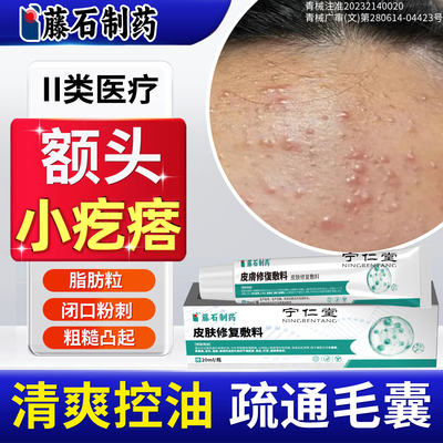 额头上起小疙瘩去闭口粉刺痘痘可搭药膏医用级脂肪粒脸上逆光疹YU