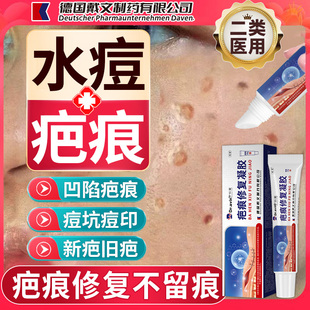 水痘疤痕修水痘坑痘印复凹洞可搭配生长因子祛陷疤膏儿童孩成人MY