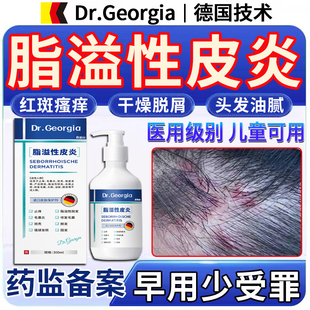 儿童头皮屑脂溢性皮炎去真菌感染头癣毛囊炎头部喷剂专用洗发水A