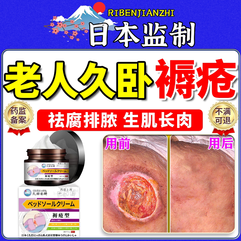 褥疮膏老人臀部外用久卧压疮特伤口愈促进效长肉消快速药Y
