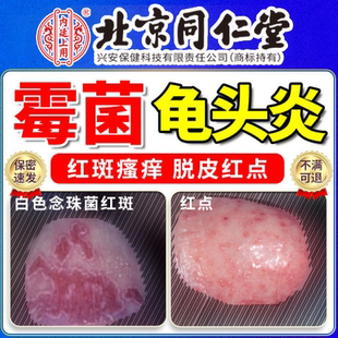 男性龟头炎专用症真菌感染霉菌性喷剂男性专用私处上有小红点Y