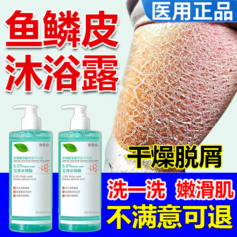 鱼鳞皮沐浴露专用滋润大腿粗糙全身干燥瘙痒止痒去鸡皮蛇皮肤WW,保健用品,皮肤消毒护理（消）,淘宝优惠券,粉丝福利购,淘宝优惠卷