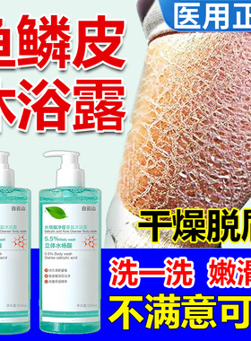 鱼鳞皮沐浴露专用滋润大腿粗糙全身干燥瘙痒止痒去鸡皮蛇皮肤WW