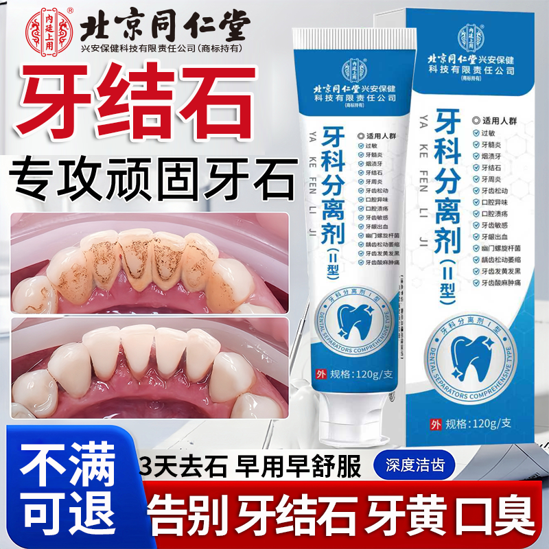 医用去牙结石溶解牙石速清理清除神器去黄去口臭美白去烟渍牙膏Y