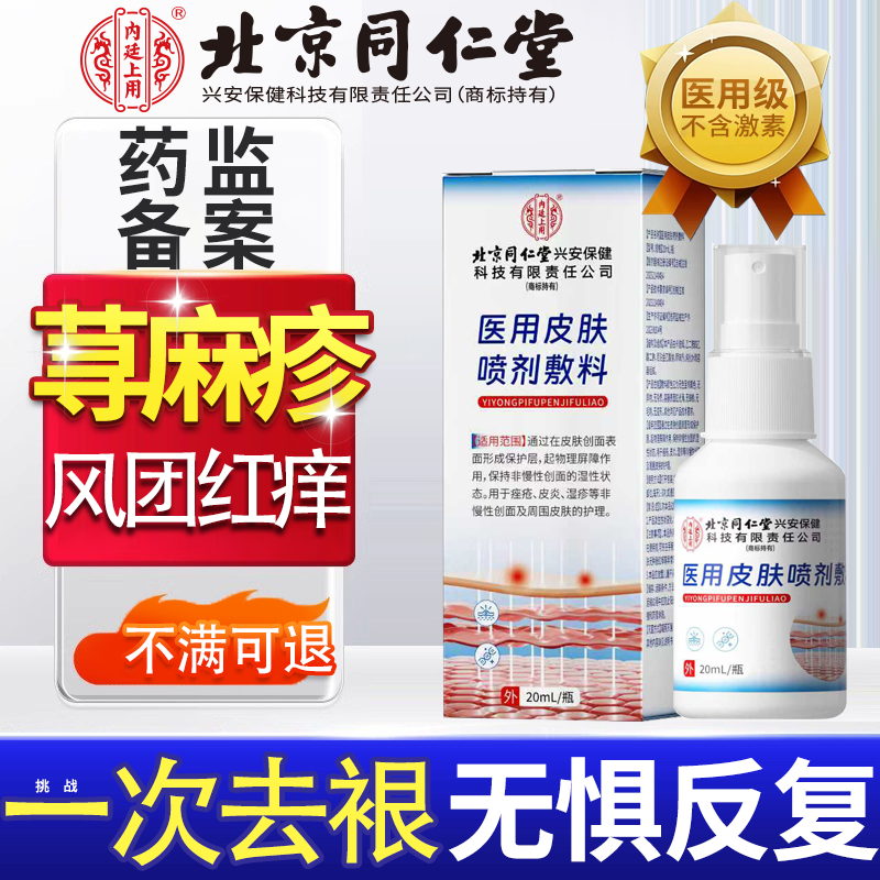 急慢性寻荨麻疹过敏止痒断的专用特效根提高免疫力治疗风团红肿Y