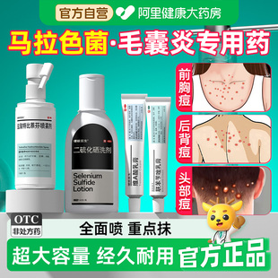 硬核医生盐酸特比萘芬喷雾剂马拉色菌药毛囊炎前胸后背胸口祛痘