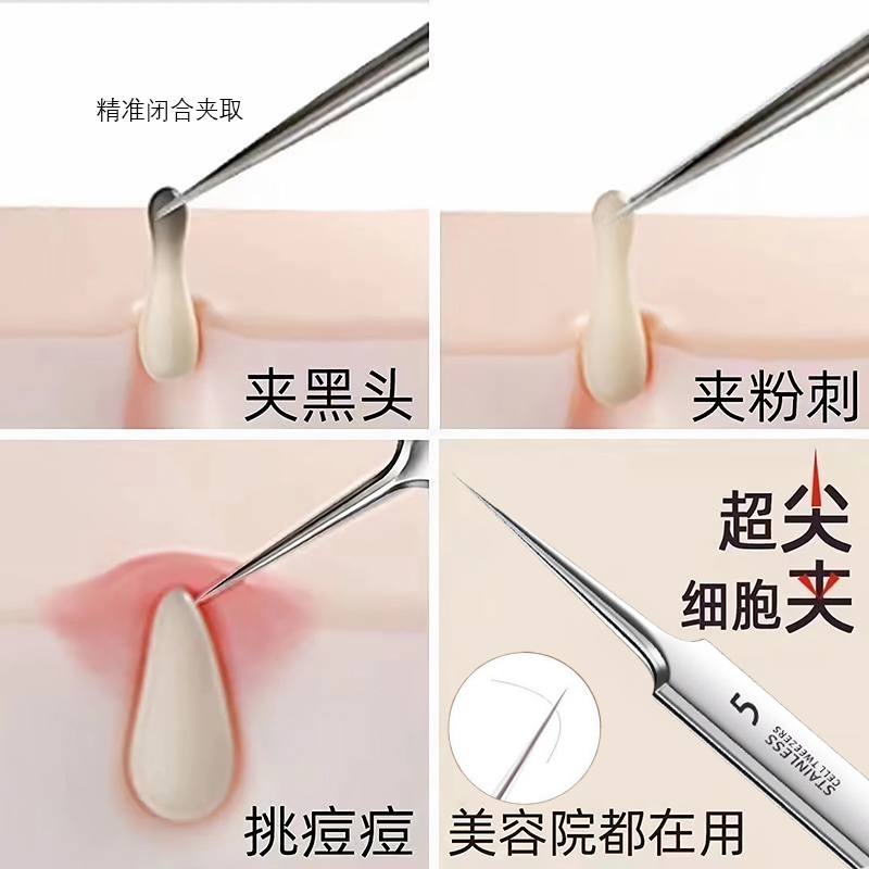 超尖粉刺针医美专用去闭口神器