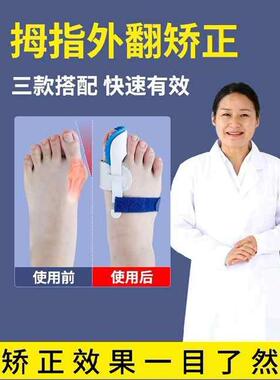 儿童拇外翻矫正器夜用小孩拇指大脚趾矫形带成人脚拐骨大脚骨纠正