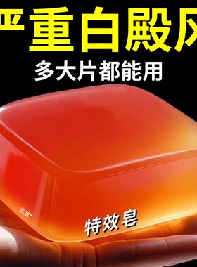 【全网热销10w+】白巅风皂外用黑色素白斑皂非308白癜风光疗仪