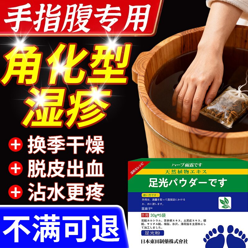 烛光粉手癣湿疹泡手泡脚包真菌感染外用泡皮肤去湿症止痒脱皮干裂