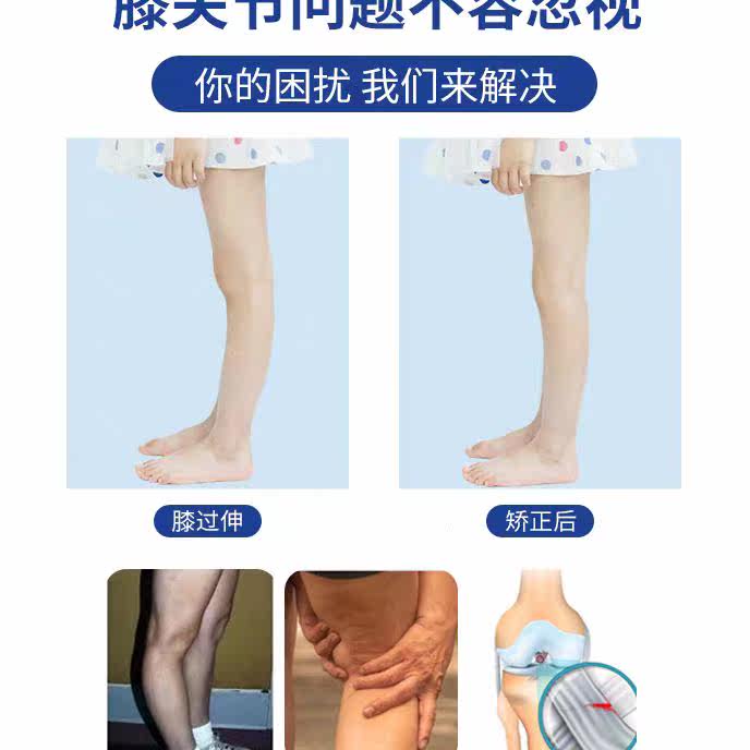 儿童护膝宝宝膝过伸矫形器膝反张膝关节韧带松o弛纠正保护康复用