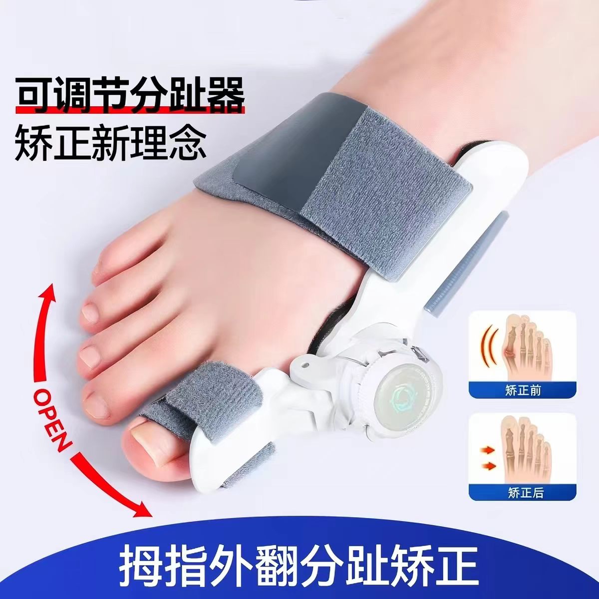 大拇指外翻矫正器可调节改善分离