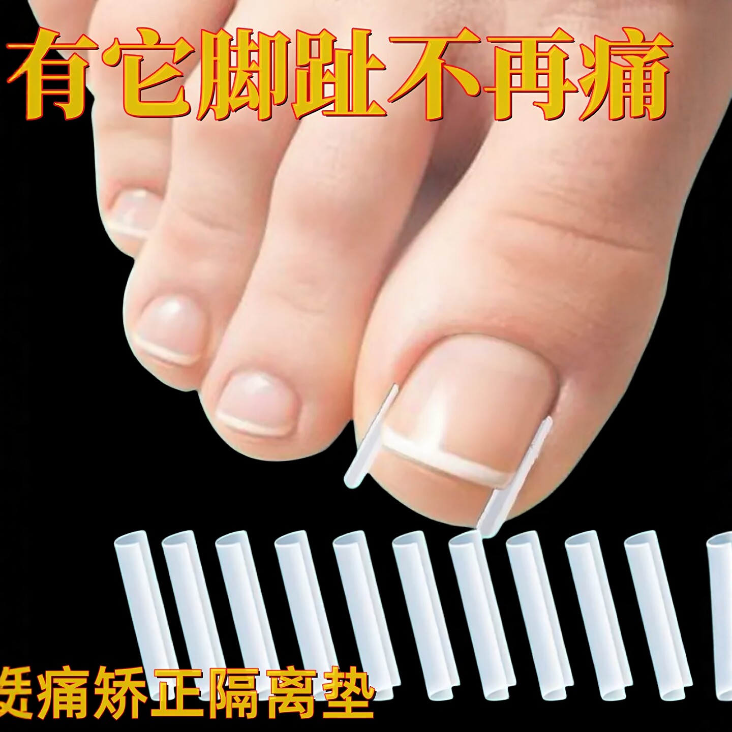甲沟炎矫正神器嵌甲隔离填充垫