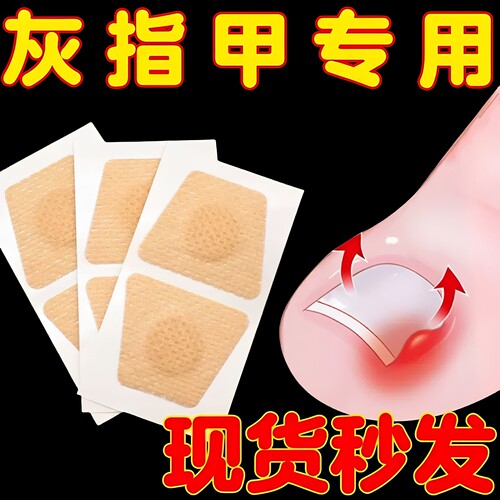 灰指甲防水防蹭透气防护贴创可贴