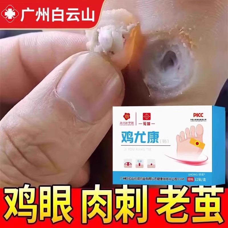广药鸡眼药膏贴官方正品旗舰店