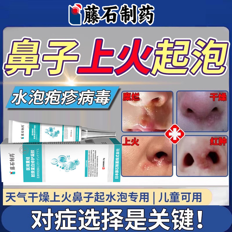 鼻子上火起泡干燥生疮下面