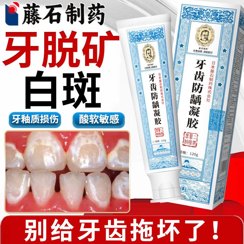 牙釉质损伤牙齿脱矿修复修补液含氟涂氟儿童有白斑牙膏敏感酸痛VQ