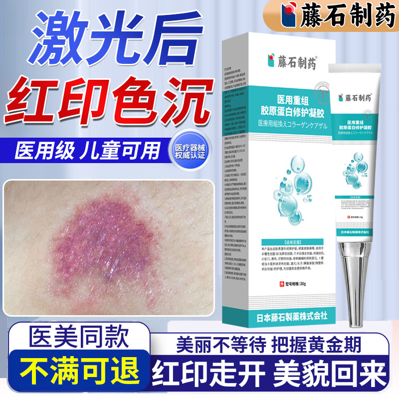 淡化点阵激光痣后去红印修