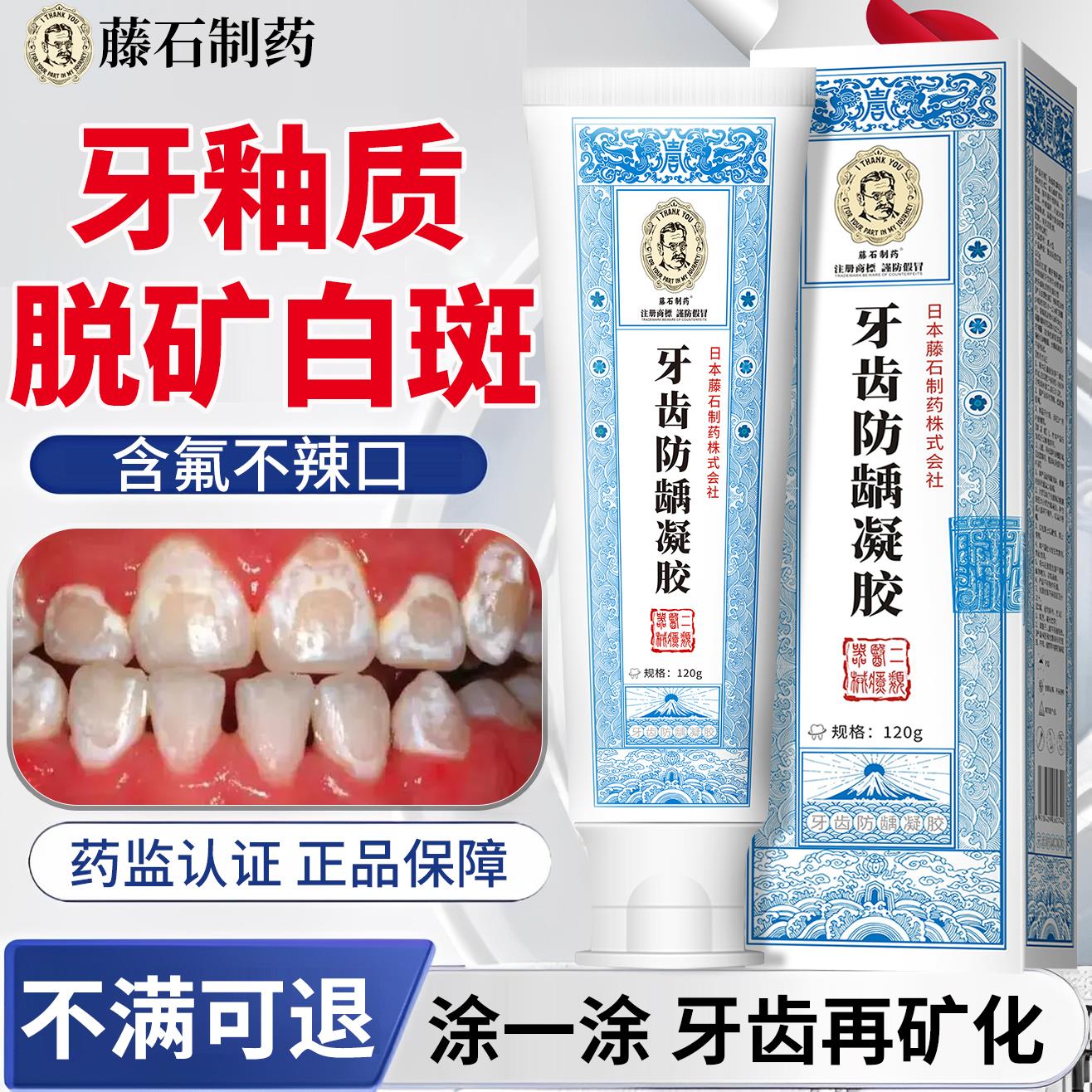 牙齿脱矿白斑钙化修复牙釉质再矿化儿童补矿含氟可搭牙膏用HT